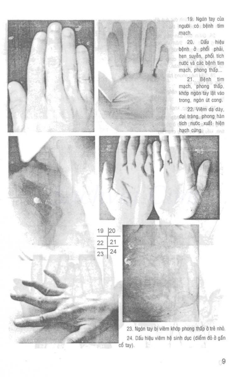 Giải Mã Cuộc Đời - 8