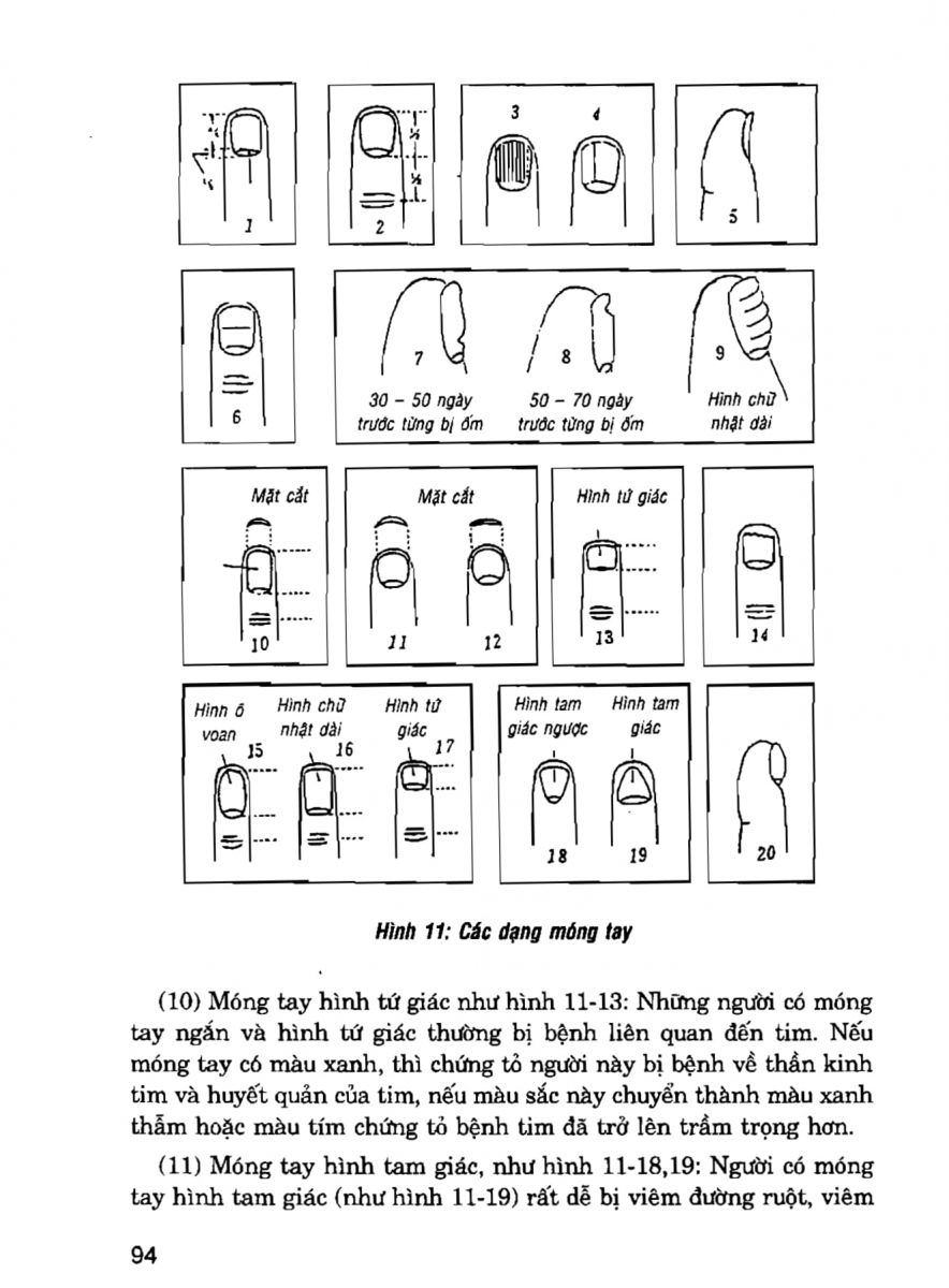 Giải Mã Cuộc Đời - 92