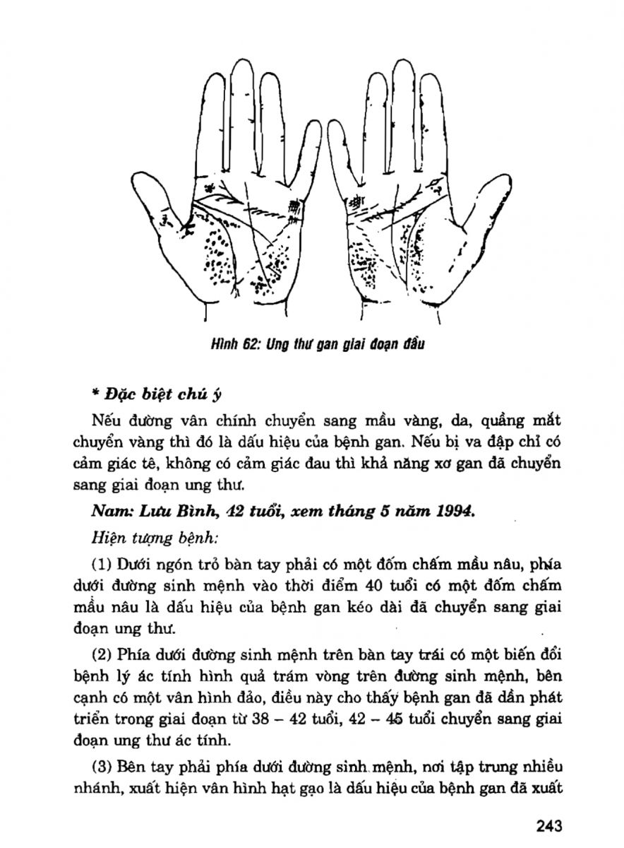 Giải Mã Cuộc Đời - 241