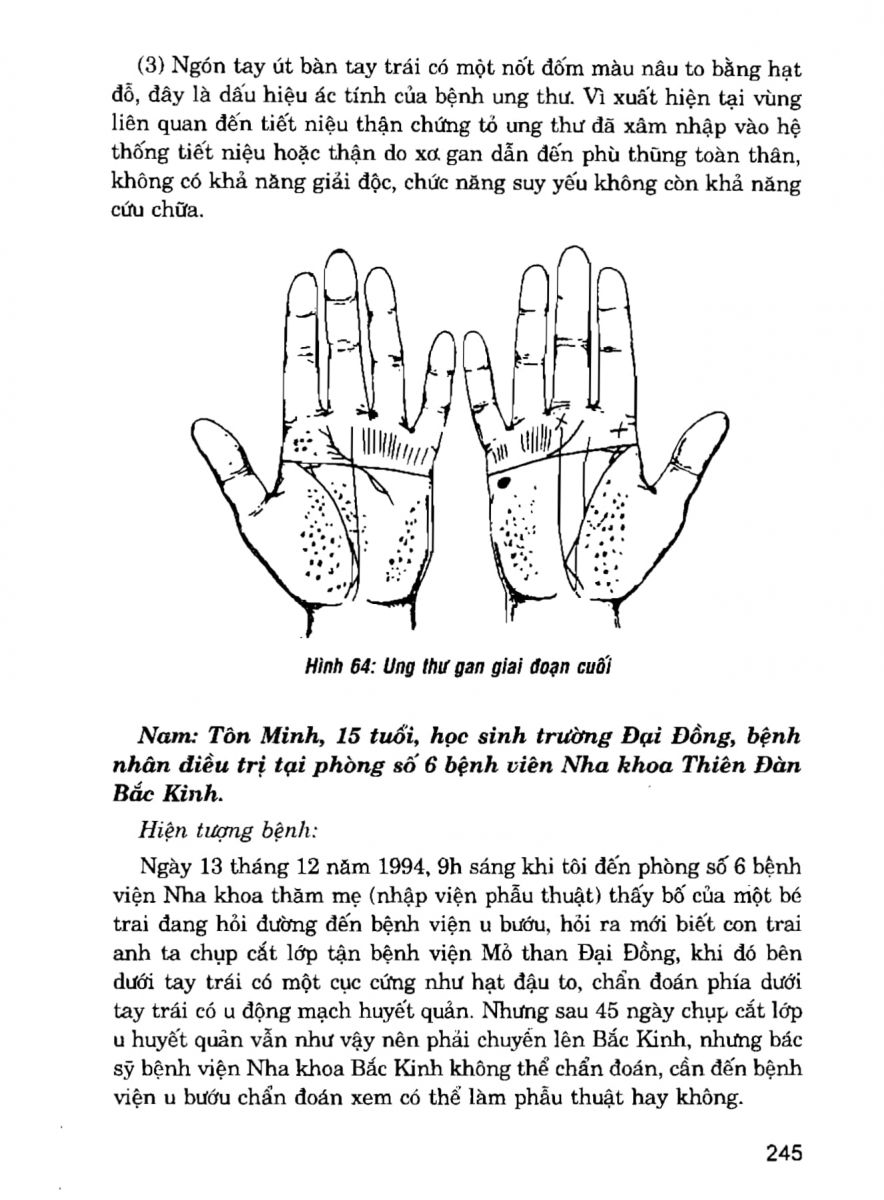 Giải Mã Cuộc Đời - 243