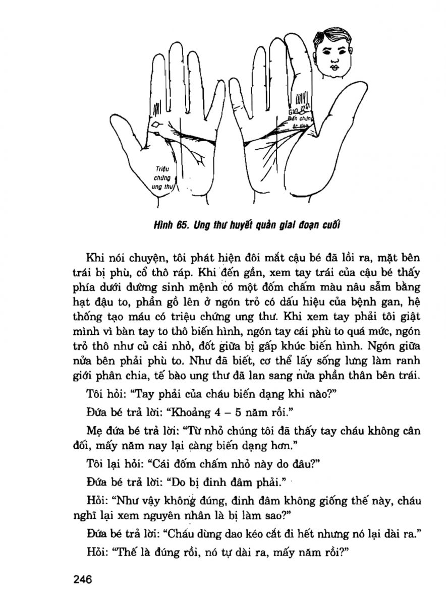 Giải Mã Cuộc Đời - 244