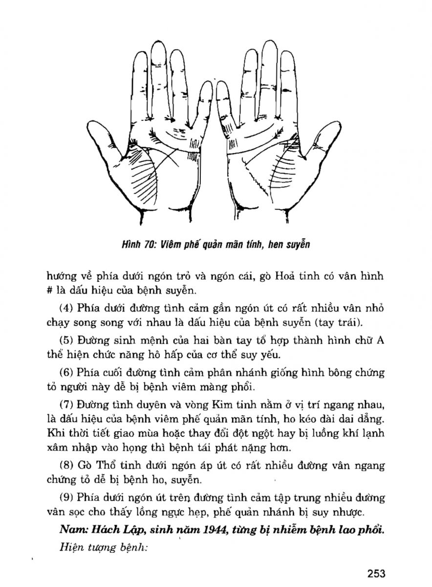 Giải Mã Cuộc Đời - 251