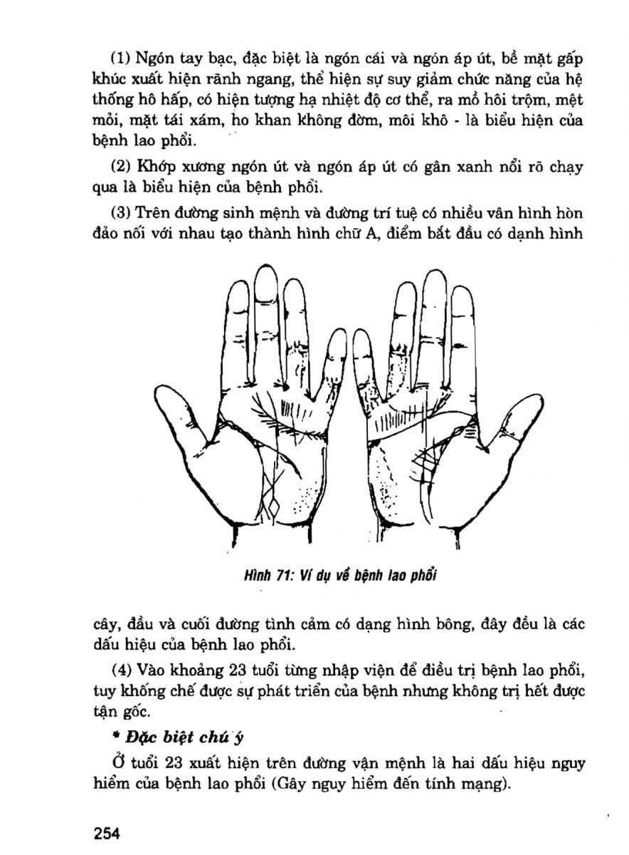 Giải Mã Cuộc Đời - 252