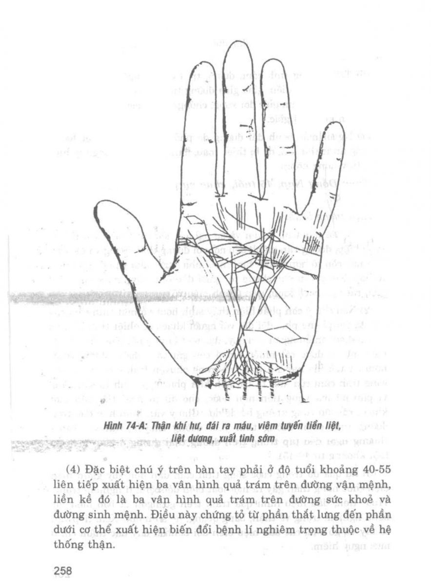 Giải Mã Cuộc Đời - 256