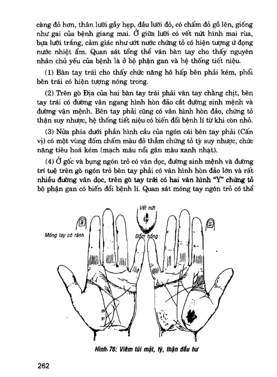 Giải Mã Cuộc Đời - 260