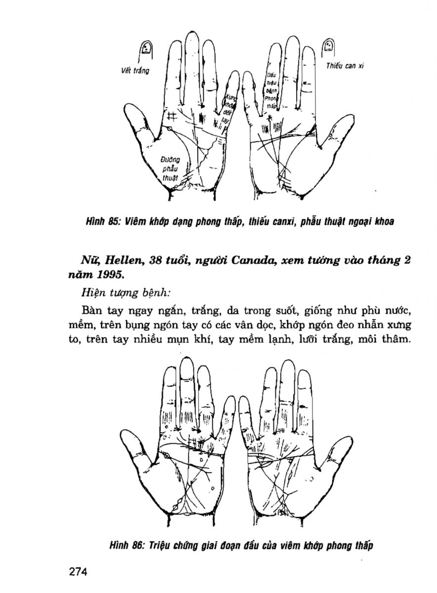 Giải Mã Cuộc Đời - 272