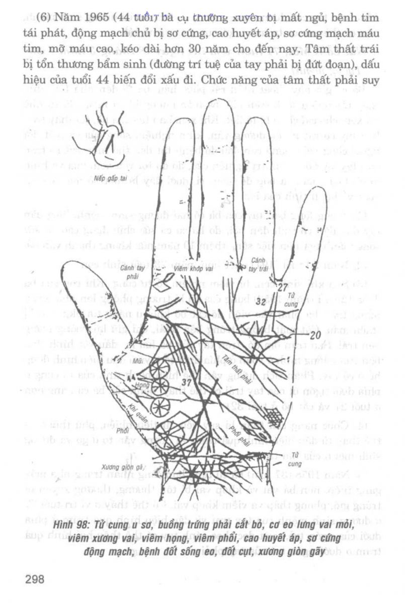 Giải Mã Cuộc Đời - 296