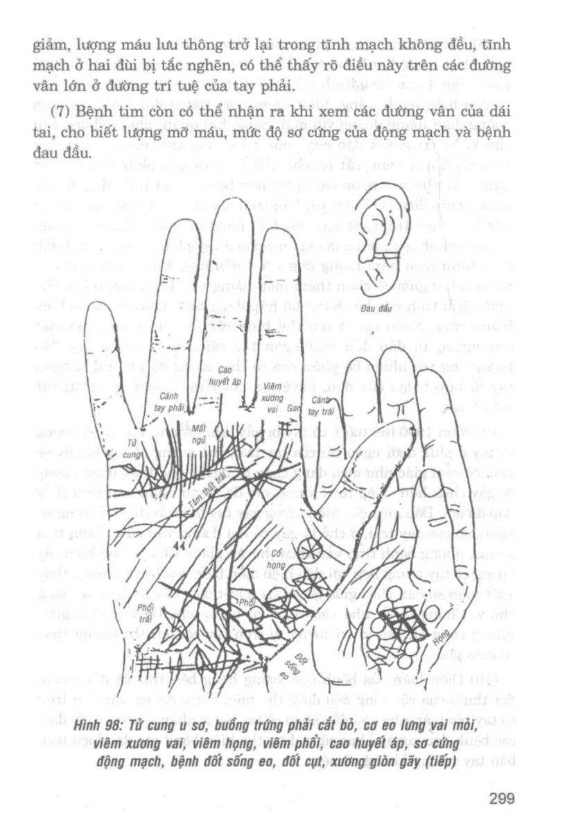 Giải Mã Cuộc Đời - 297