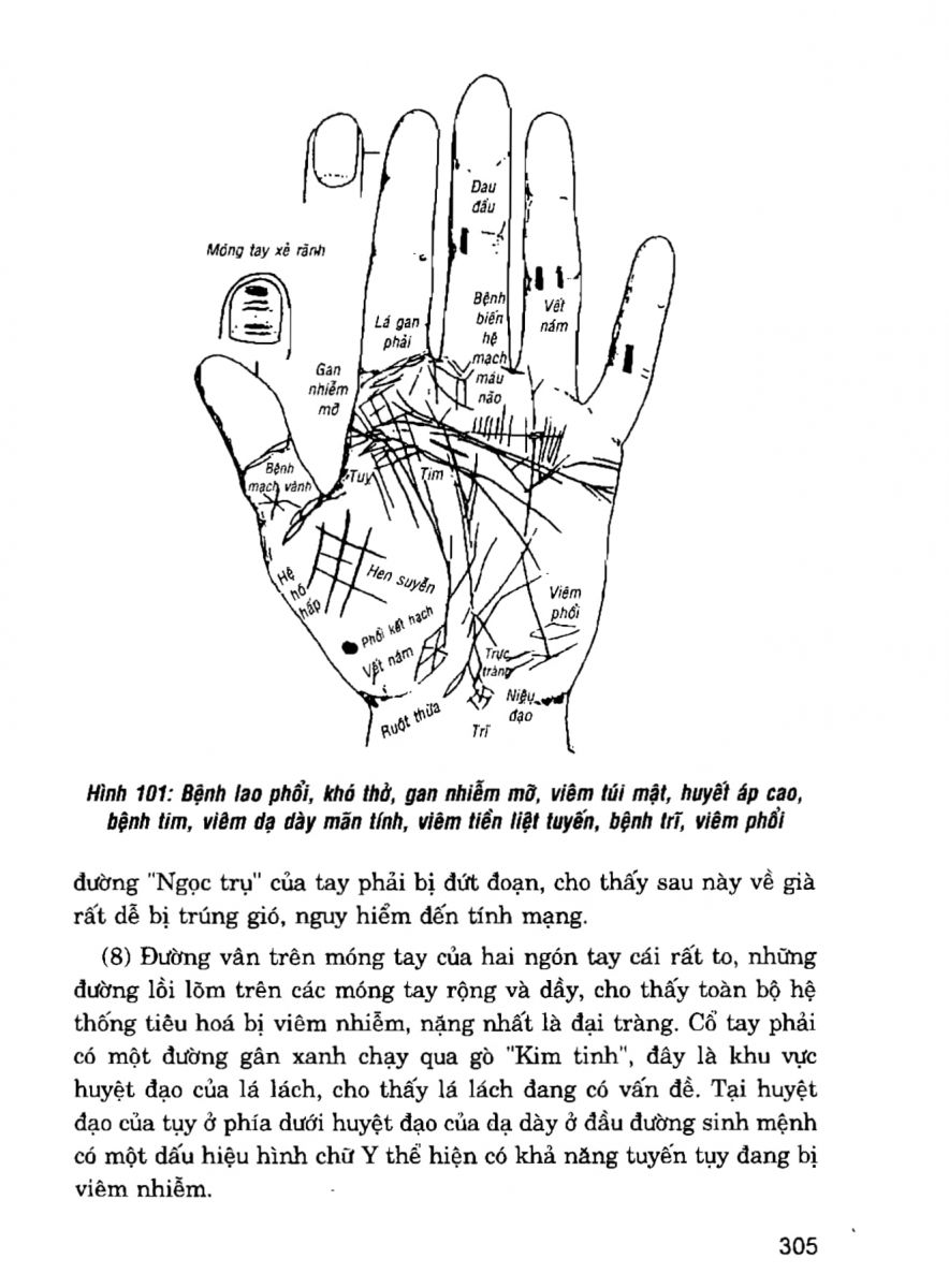Giải Mã Cuộc Đời - 303