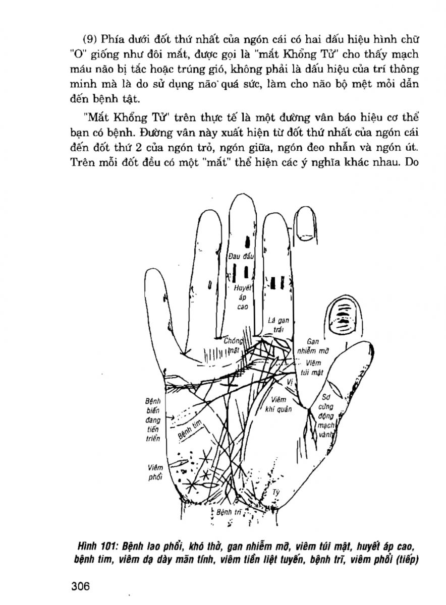 Giải Mã Cuộc Đời - 304