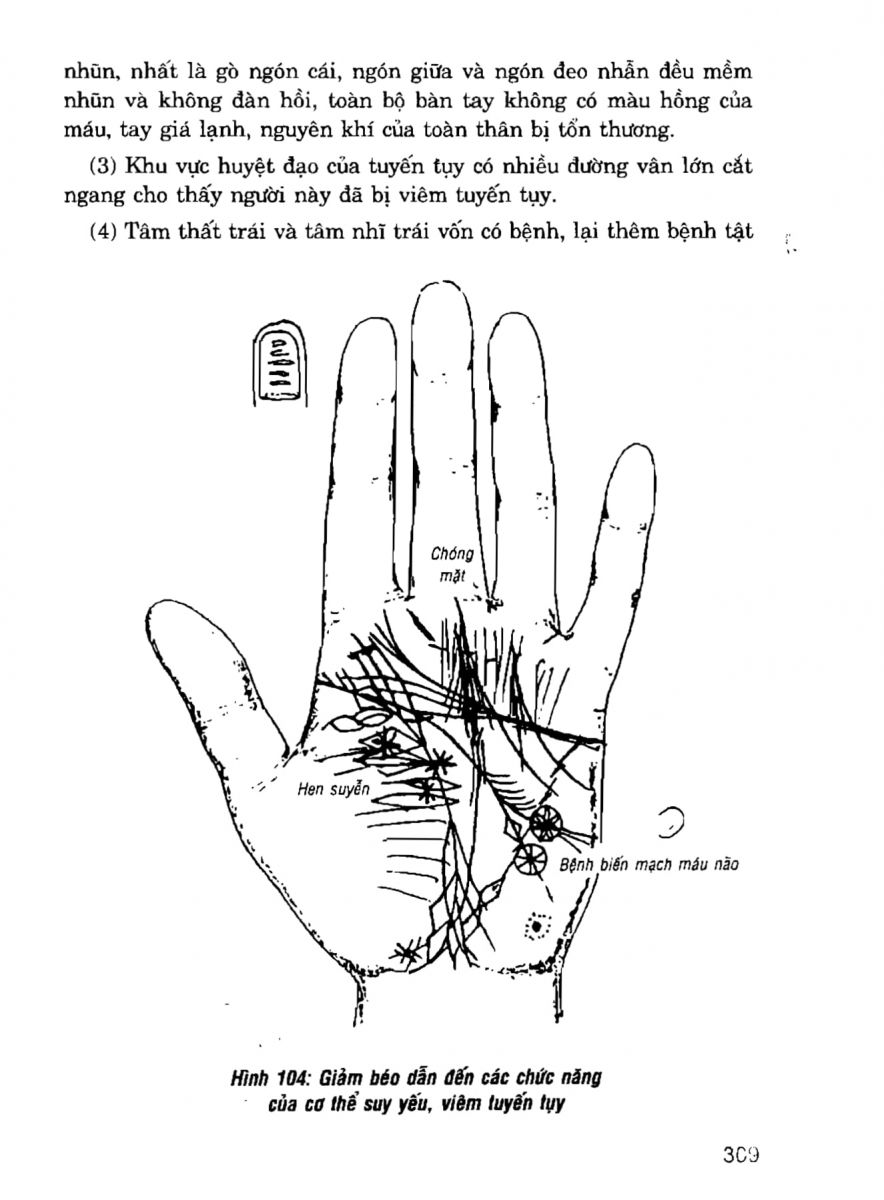 Giải Mã Cuộc Đời - 307