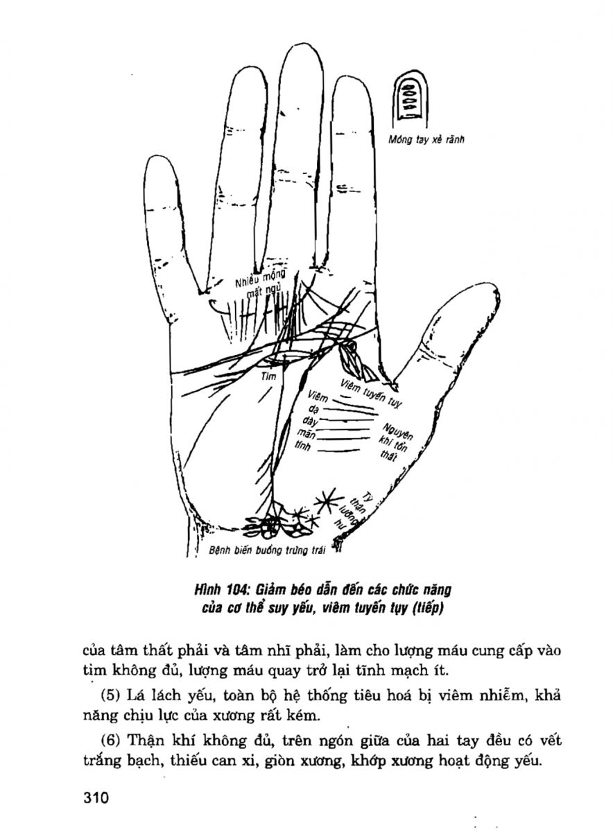 Giải Mã Cuộc Đời - 308