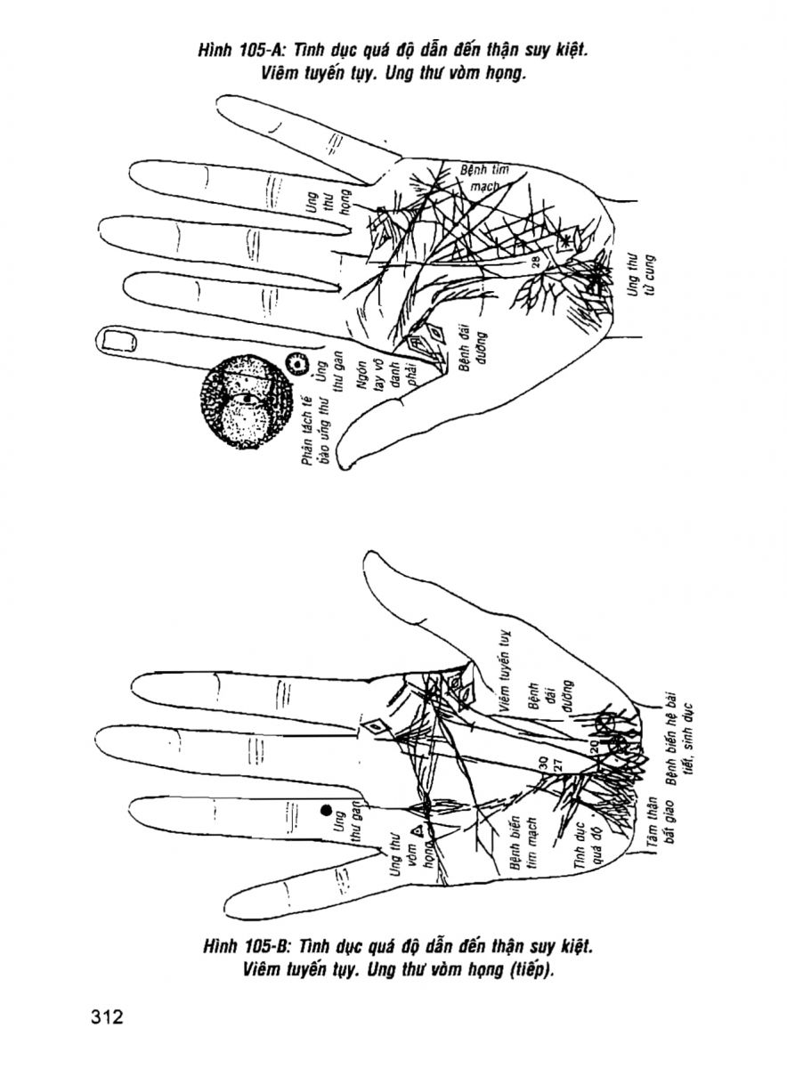 Giải Mã Cuộc Đời - 310