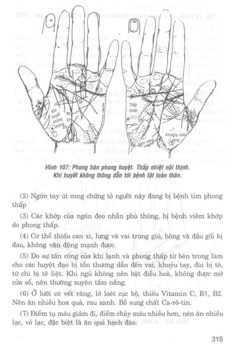 Giải Mã Cuộc Đời - 313