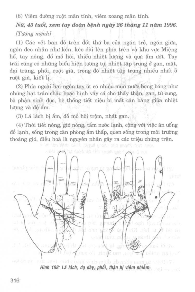 Giải Mã Cuộc Đời - 314