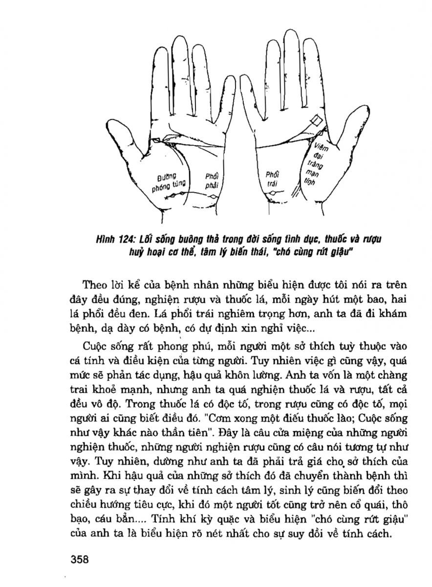 Giải Mã Cuộc Đời - 356