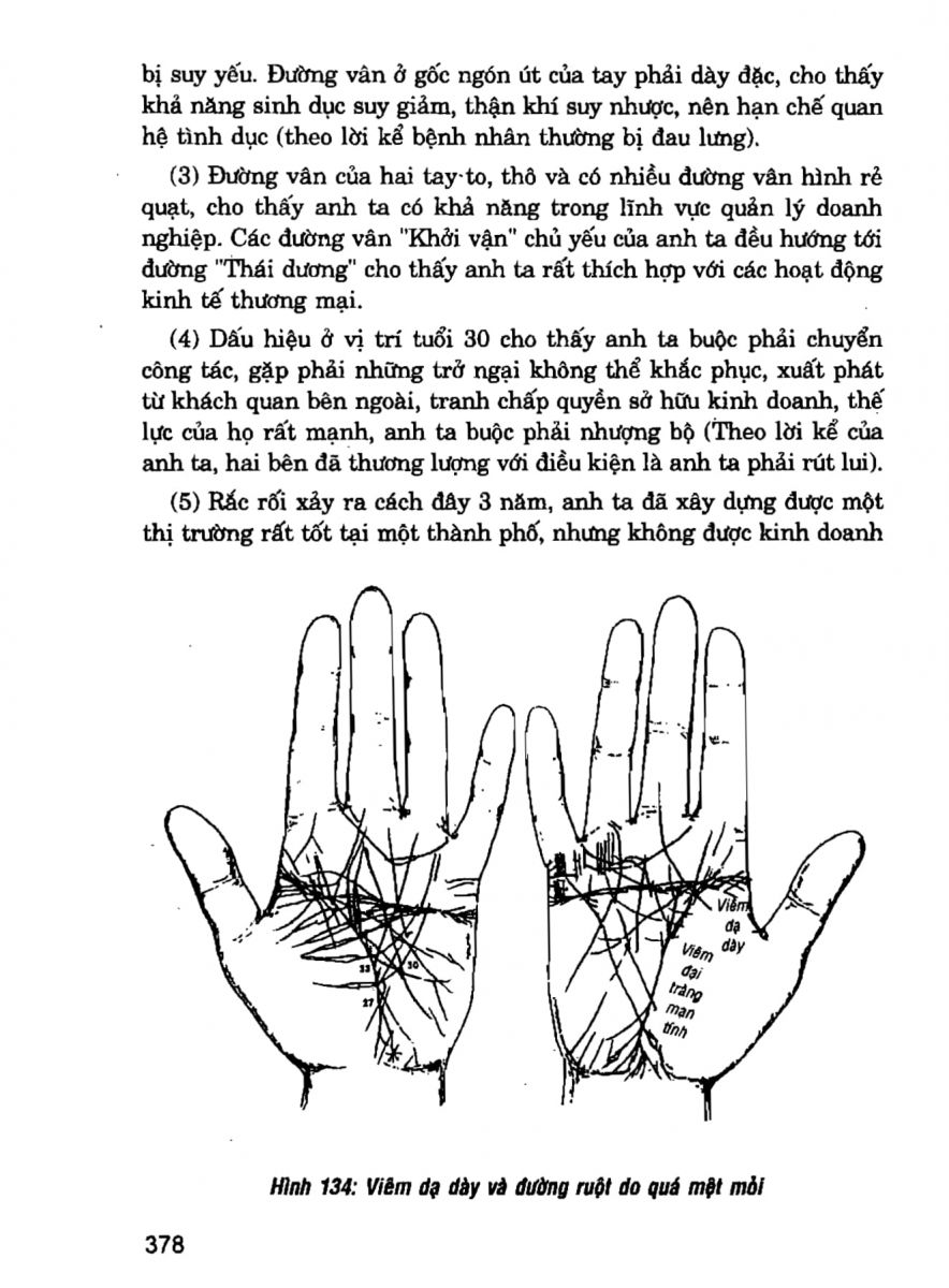 Giải Mã Cuộc Đời - 376