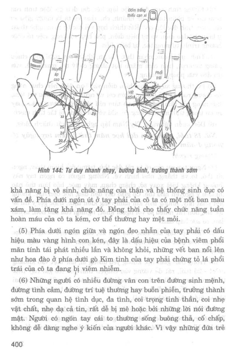 Giải Mã Cuộc Đời - 398