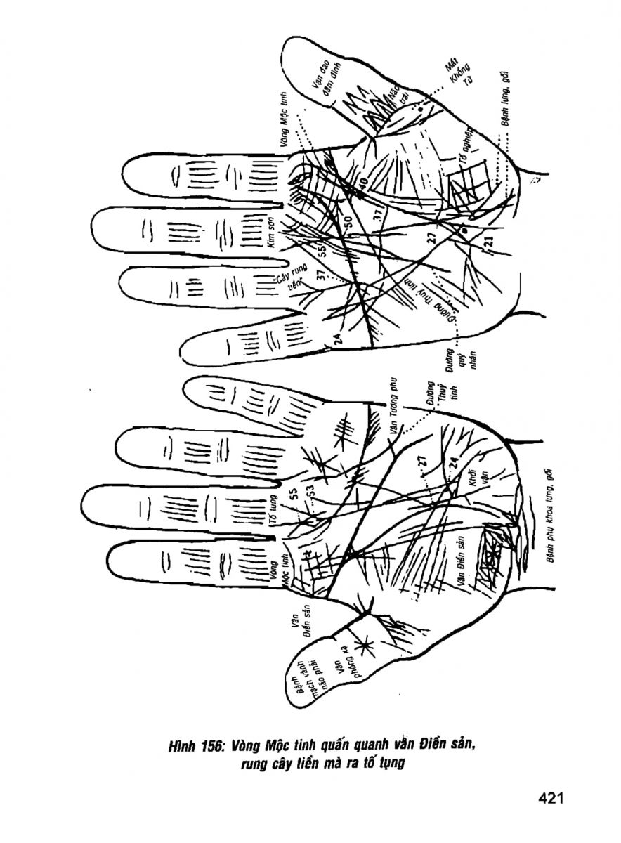 Giải Mã Cuộc Đời - 419