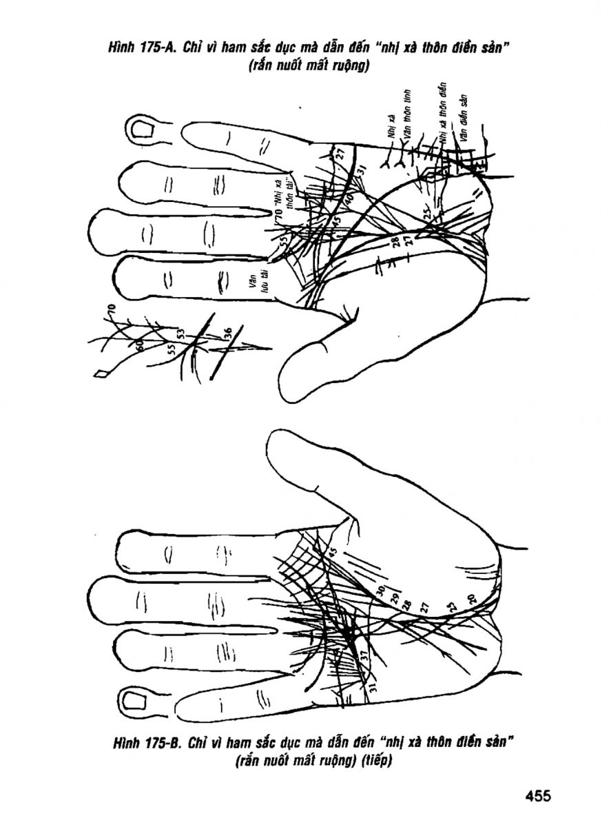 Giải Mã Cuộc Đời - 453