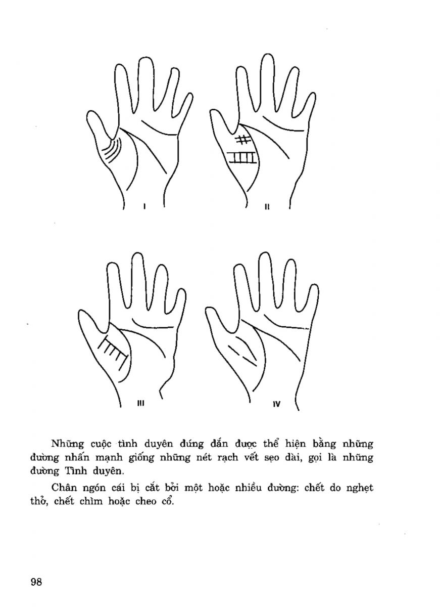 Tiếng Nói Của Bàn Tay - 93