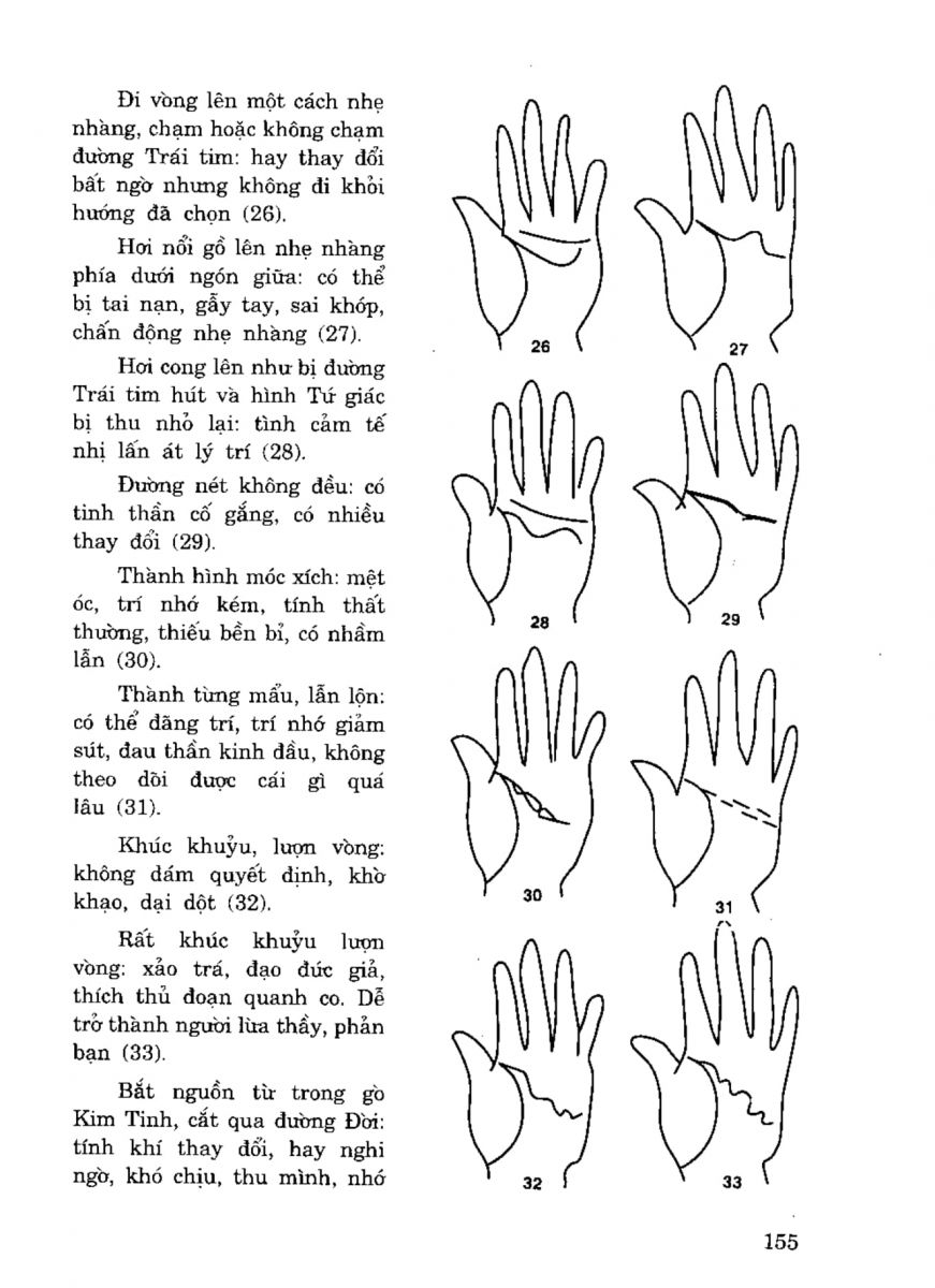 Tiếng Nói Của Bàn Tay - 150