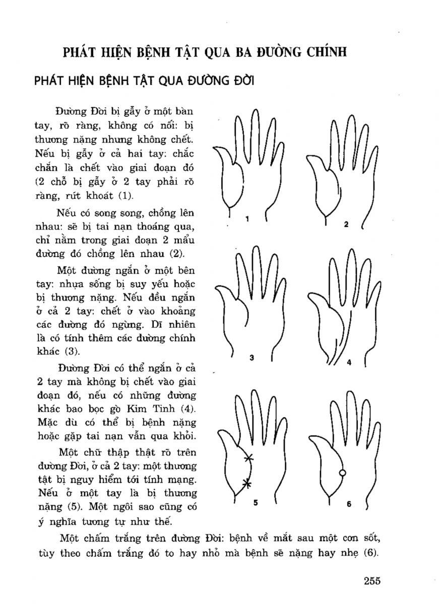 Tiếng Nói Của Bàn Tay - 250