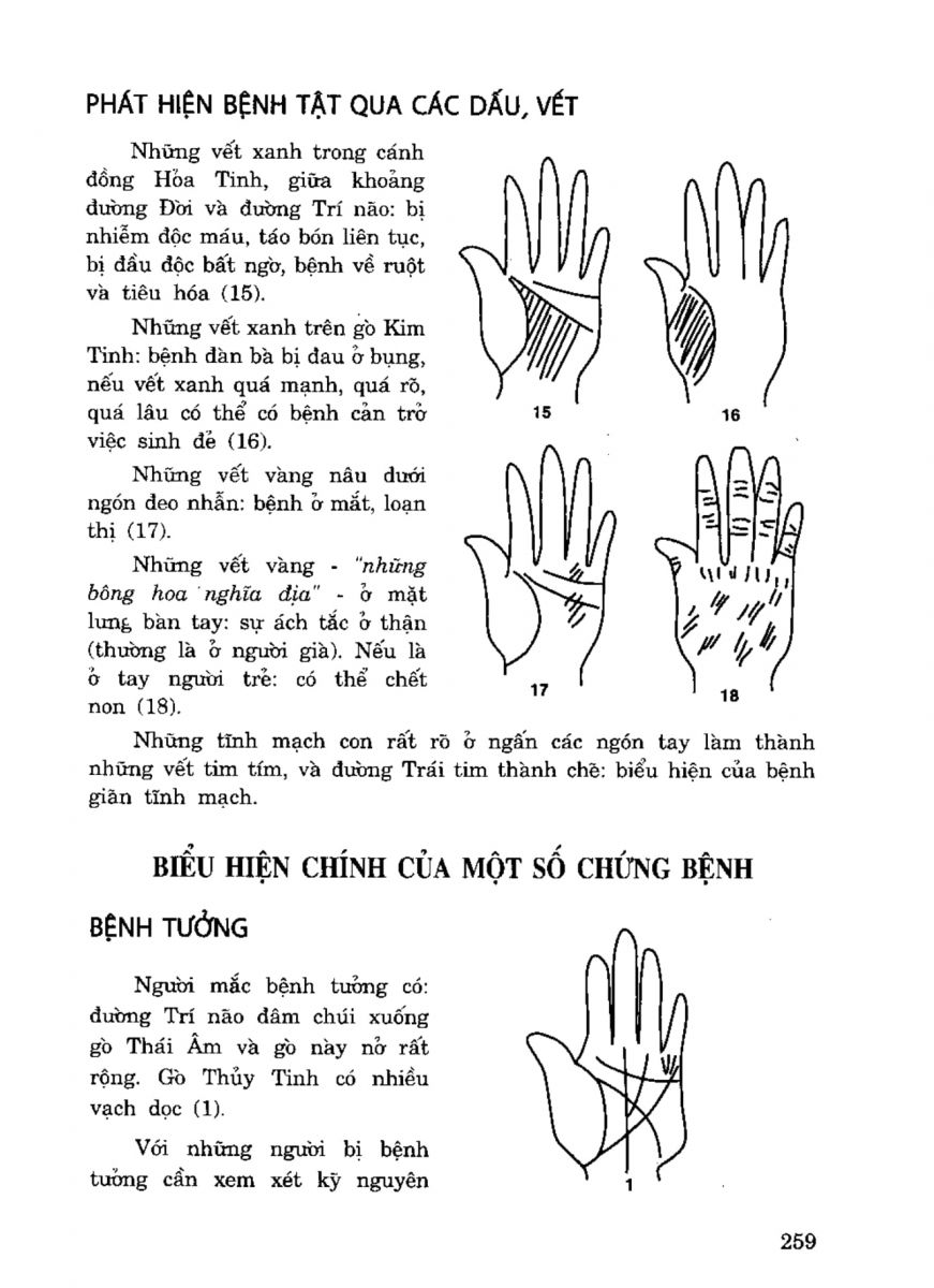 Tiếng Nói Của Bàn Tay - 254