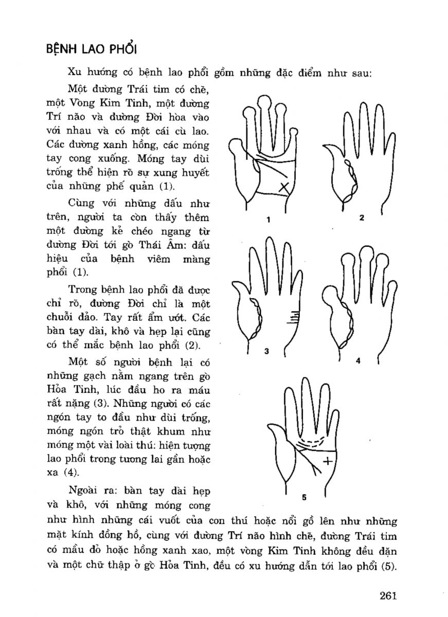 Tiếng Nói Của Bàn Tay - 256