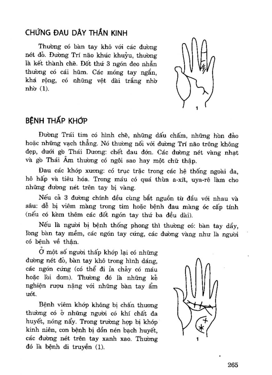 Tiếng Nói Của Bàn Tay - 260