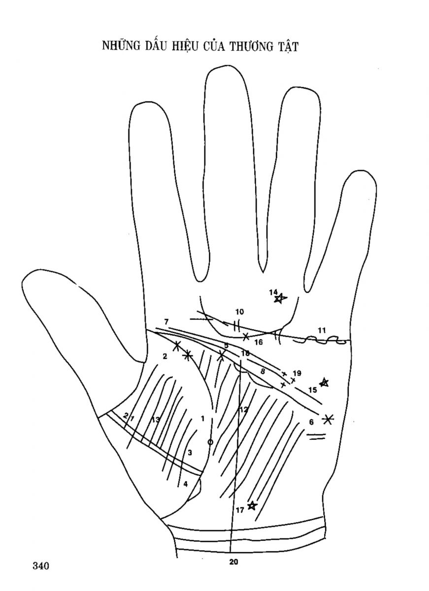 Tiếng Nói Của Bàn Tay - 335