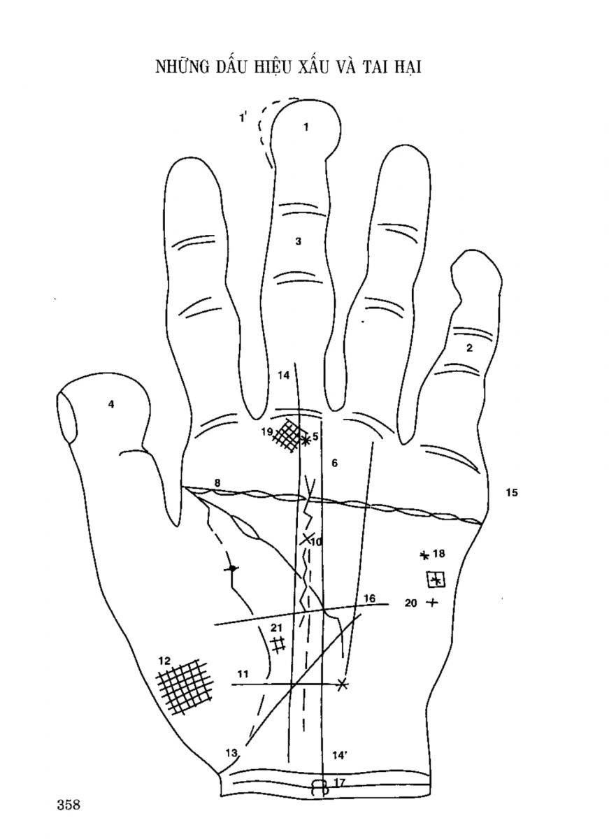 Tiếng Nói Của Bàn Tay - 353